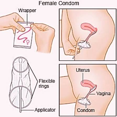 VELVET FEMALE CONDOM (FEMIDOM)